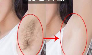 永久全身脱毛需要多少钱 永久脱毛需要多少钱